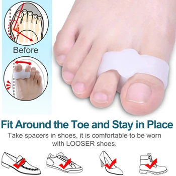 Силиконовый сепаратор для пальцев ног, 2шт, корректор вальгусной деформации стоп, облегчающий боль в ногах
